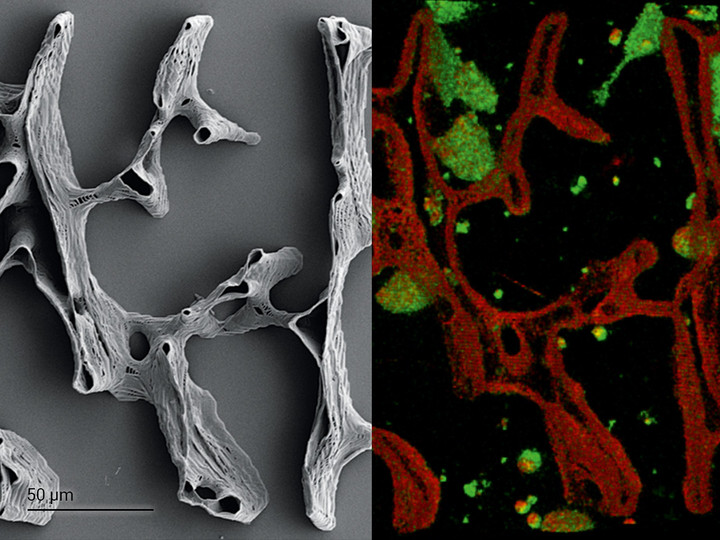 High-fidelity replication of a human trabecular bone structure from a 3D µ-CT scan.